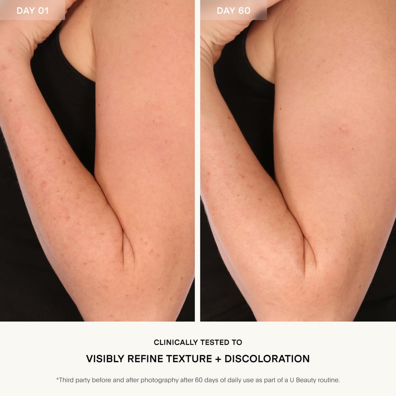 Resurfacing Body Compound