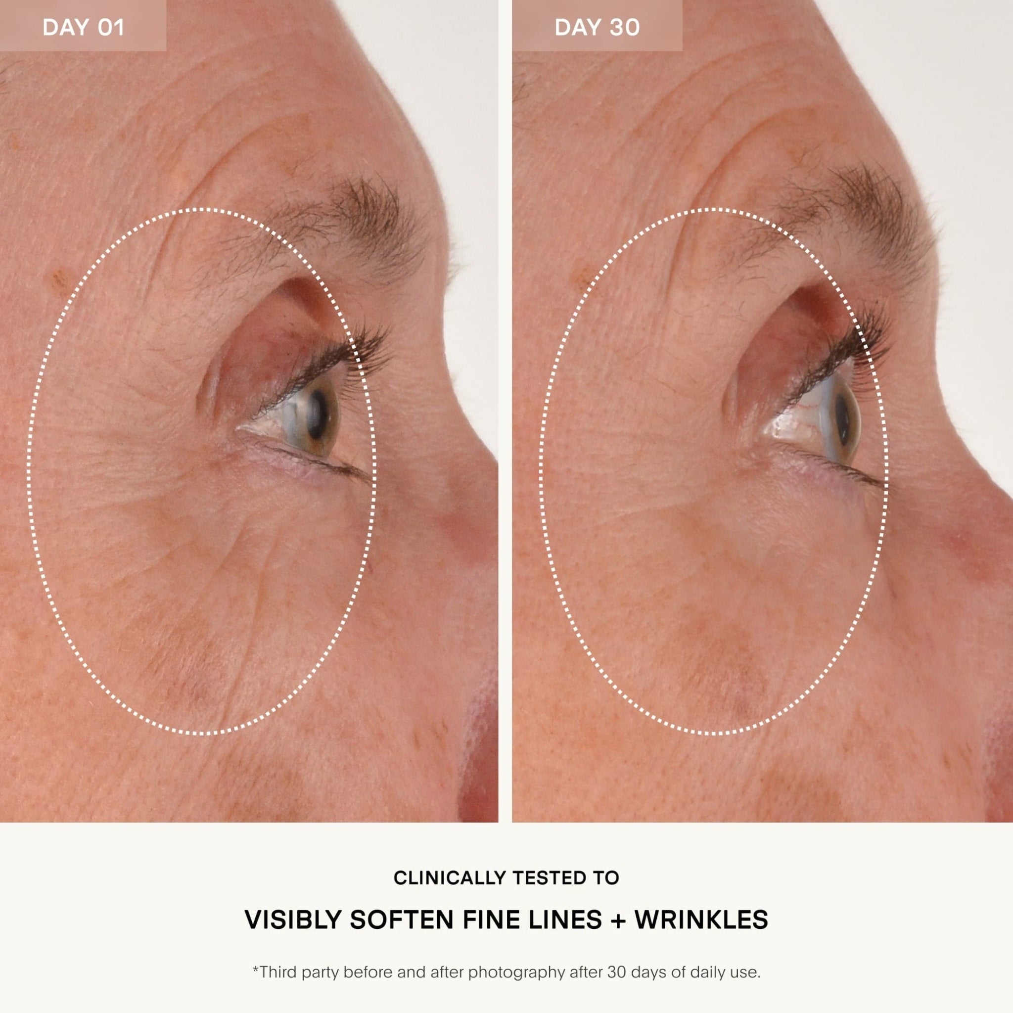 The RETURN Eye Concentrate