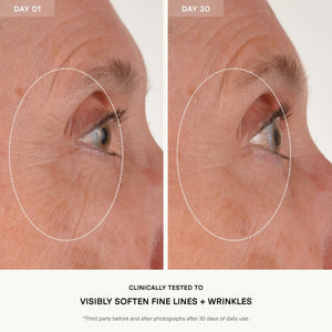 The RETURN Eye Concentrate