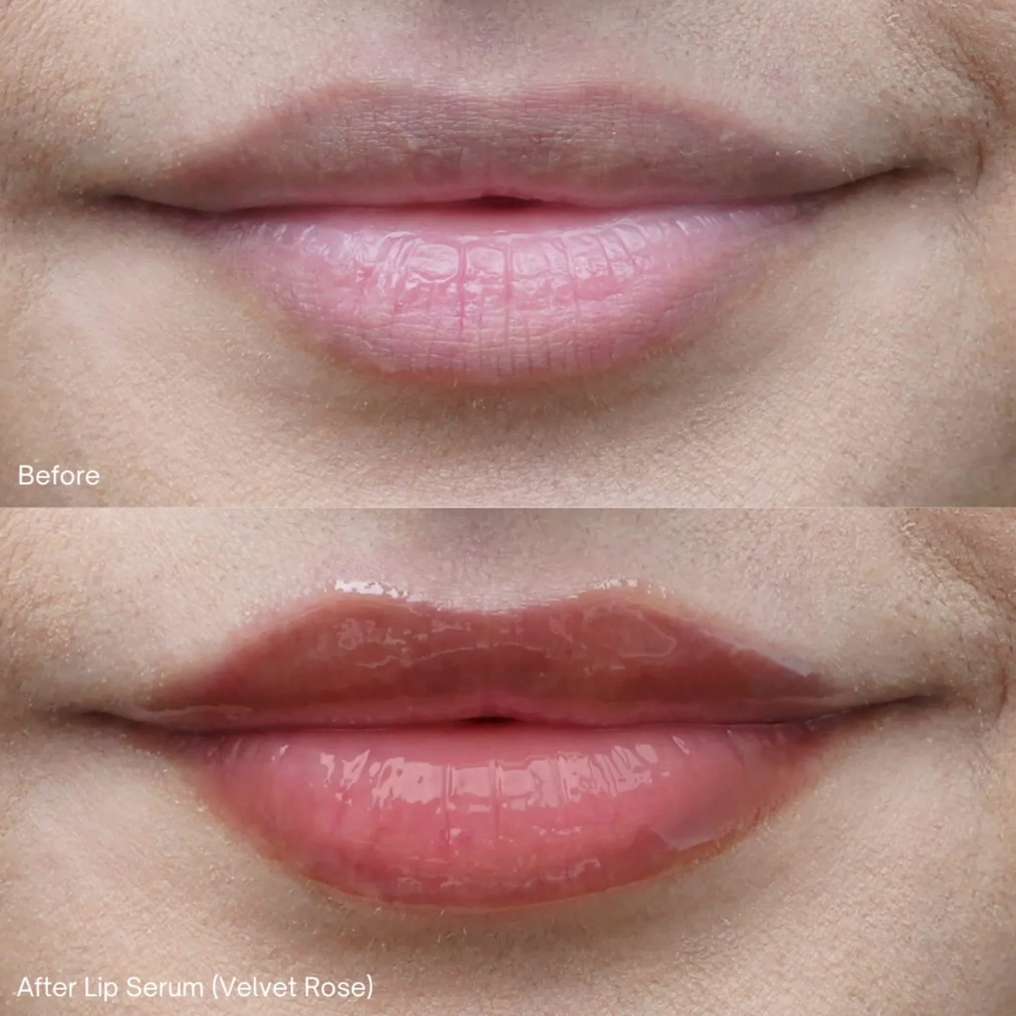 Lip Serum