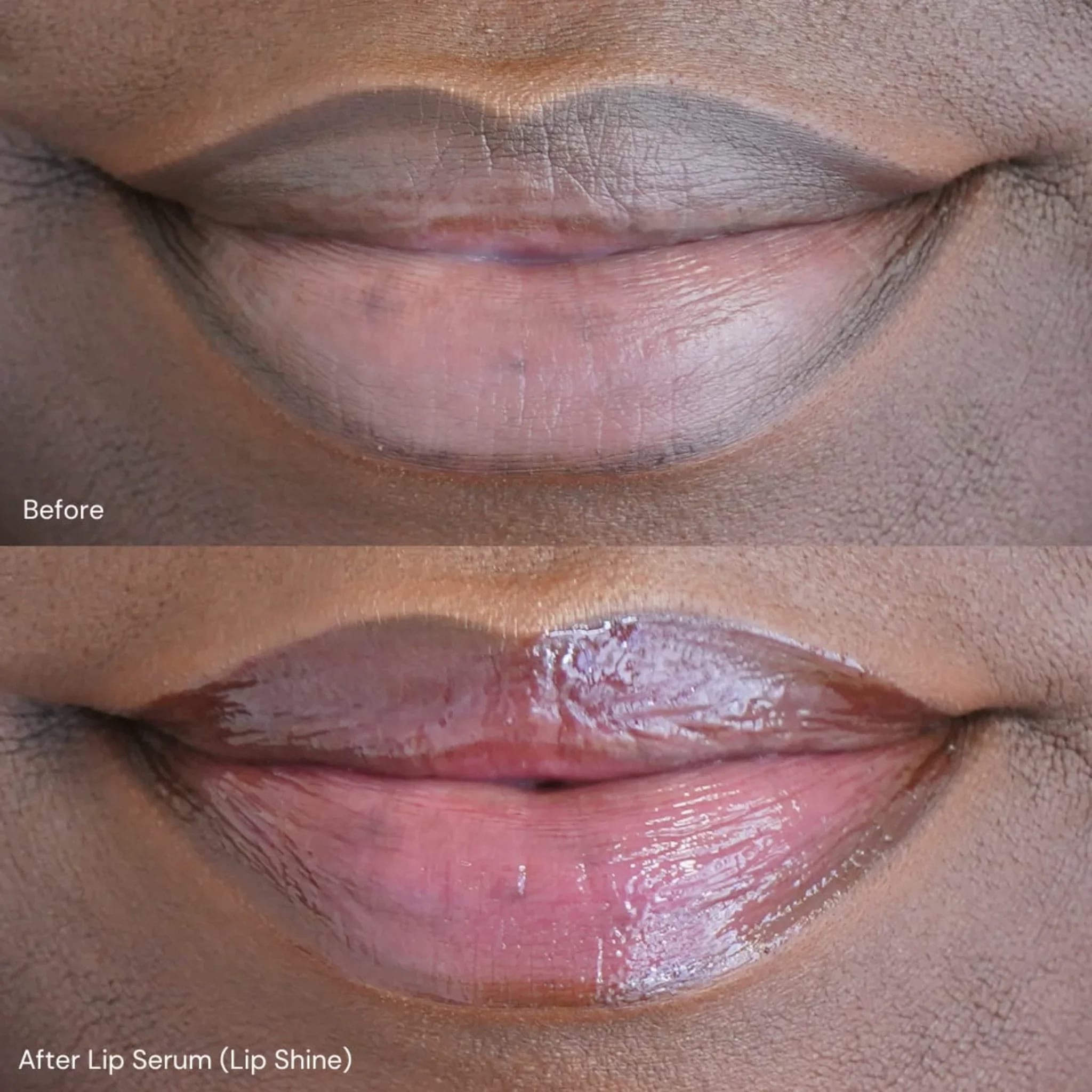 Lip Serum