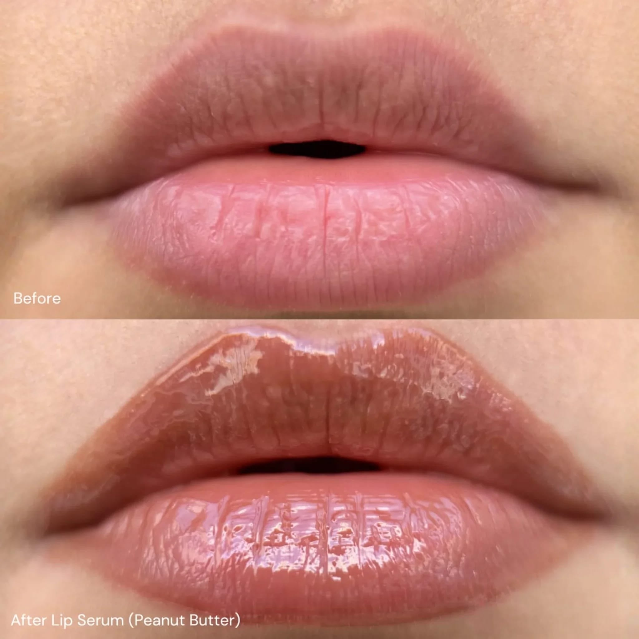 Lip Serum