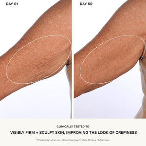 The SCULPT Arm Compound