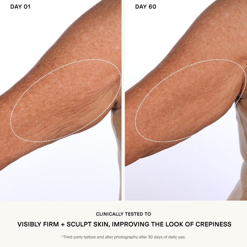 The SCULPT Arm Compound