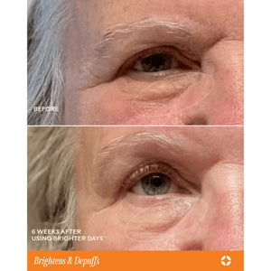 Masques pour les yeux biodégradables Brighter Days™
