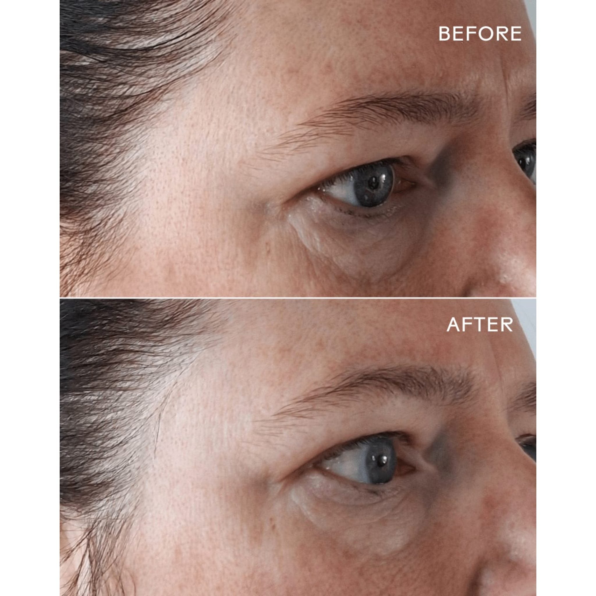EyeHero ®  Bio-Retinol Smoothing Eye Cream