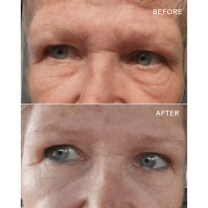 Crème lissante pour les yeux au bio-rétinol EyeHero ©