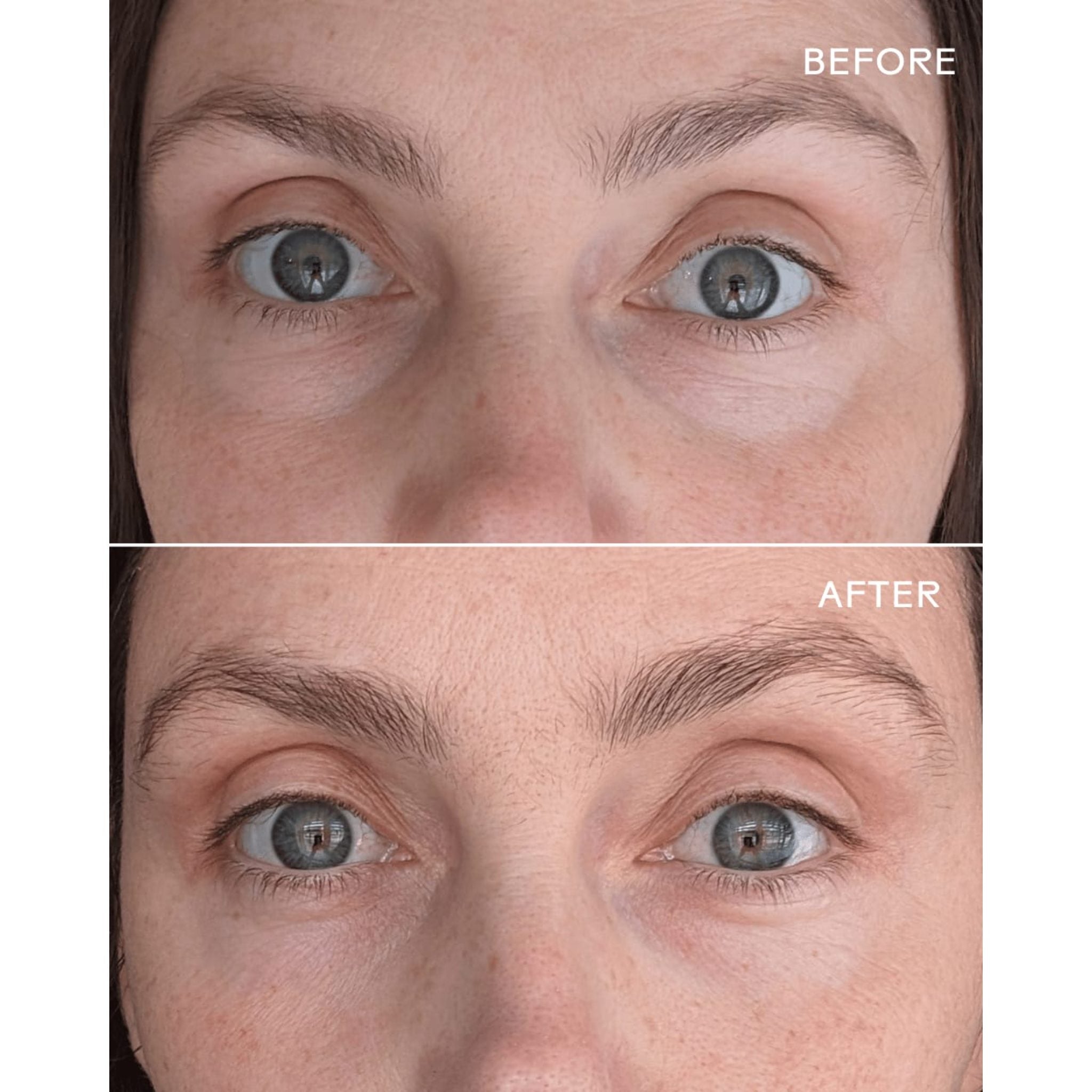 First Light® Vitamin C + Caffeine Eye Cream