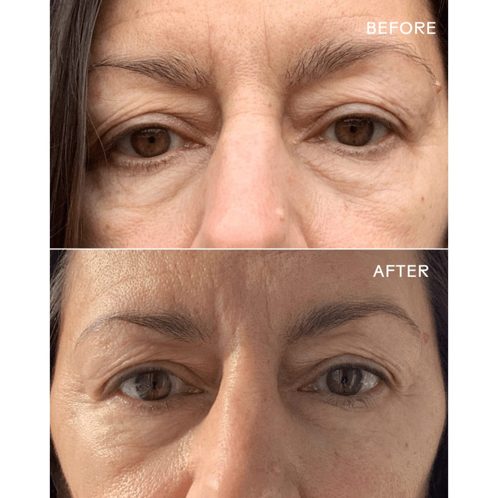First Light® Vitamin C + Caffeine Eye Cream