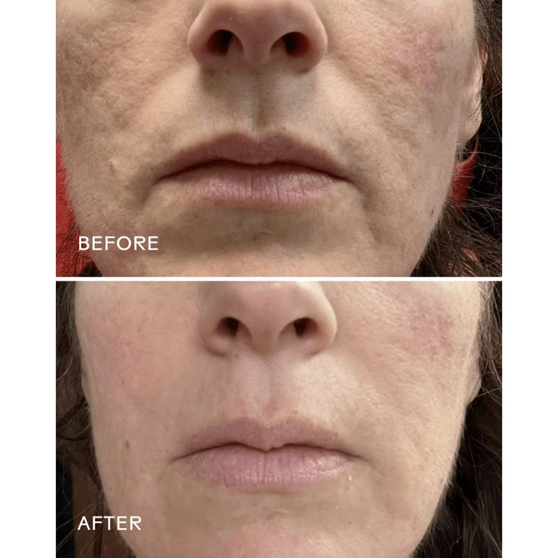 Nettoyant en gel purifiant à l'aloès et aux acides aminés Purify