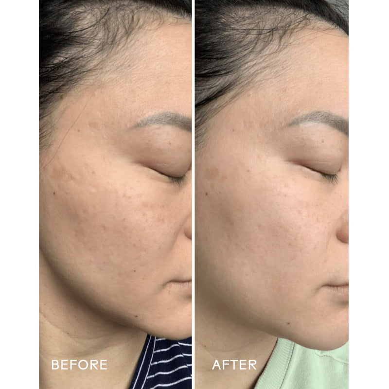 Radiance Ultra-Hydrating Cream