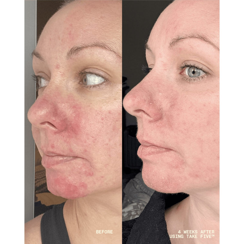 Take Five™ Balancing Body + Face Spray
