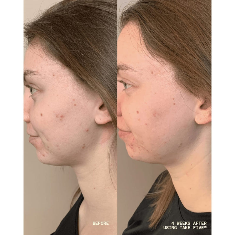 Take Five™ Balancing Body + Face Spray