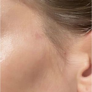 Scar Concentrate