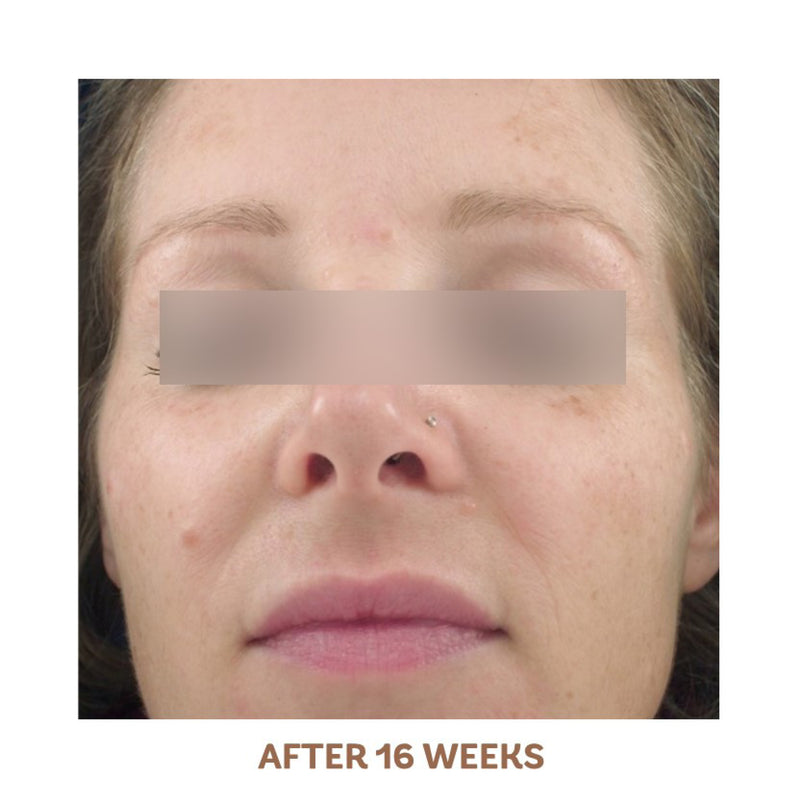Vivier Skin Radiance Serum