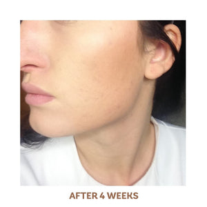 vivier aha bha exfoliating cream after